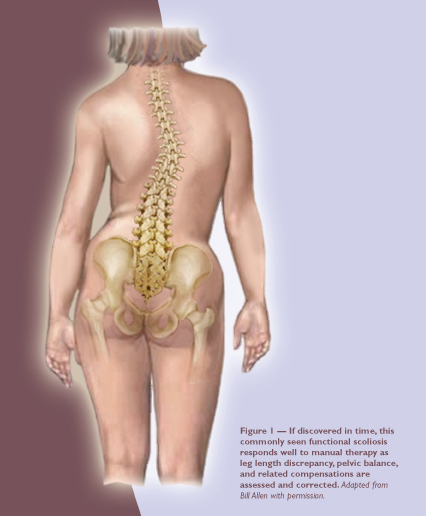 Can Massage Therapy Help Manage Scoliosis Pain & Discomfort